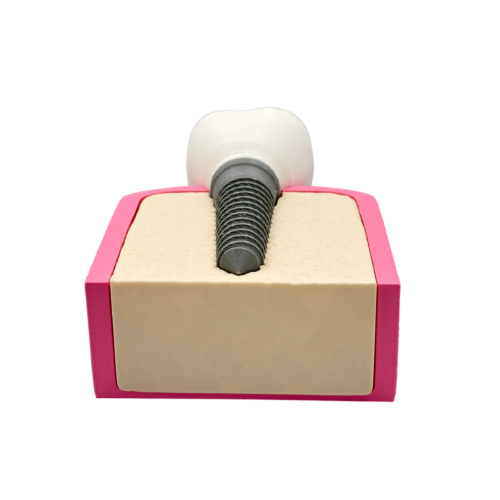 Interactive Dental Implant Anatomical Model